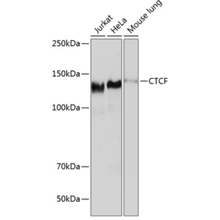 Western Blot - Anti-CTCF Antibody [ARC0067] (A308115) - Antibodies.com