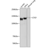 Western Blot - Anti-CTCF Antibody [ARC0067] (A308115) - Antibodies.com