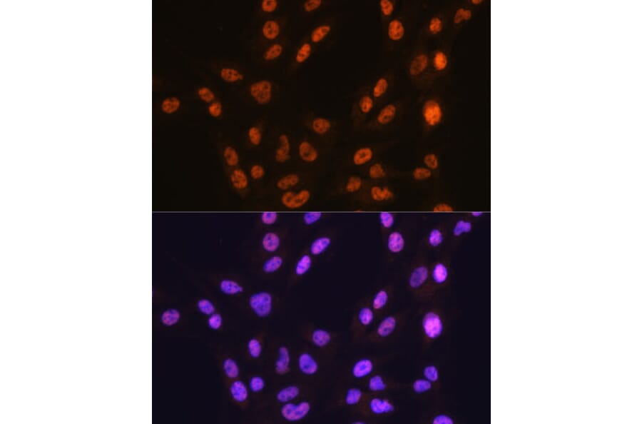 Immunofluorescence - Anti-CTCF Antibody [ARC0067] (A308115) - Antibodies.com