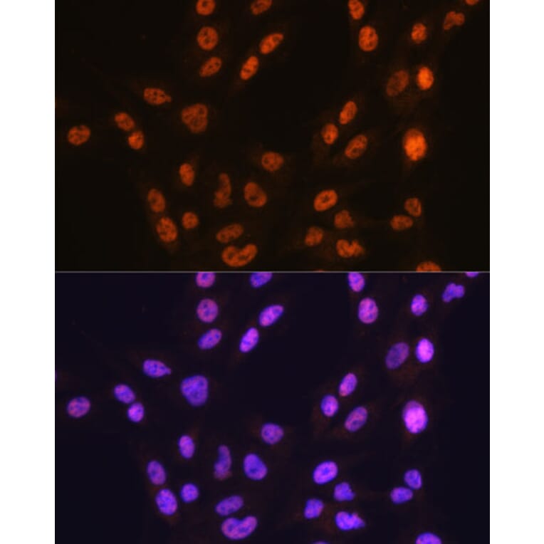Immunofluorescence - Anti-CTCF Antibody [ARC0067] (A308115) - Antibodies.com