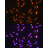 Immunofluorescence - Anti-CTCF Antibody [ARC0067] (A308115) - Antibodies.com