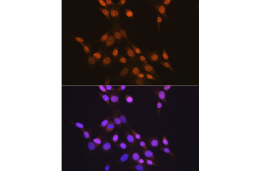 Immunofluorescence - Anti-CTCF Antibody [ARC0067] (A308115) - Antibodies.com