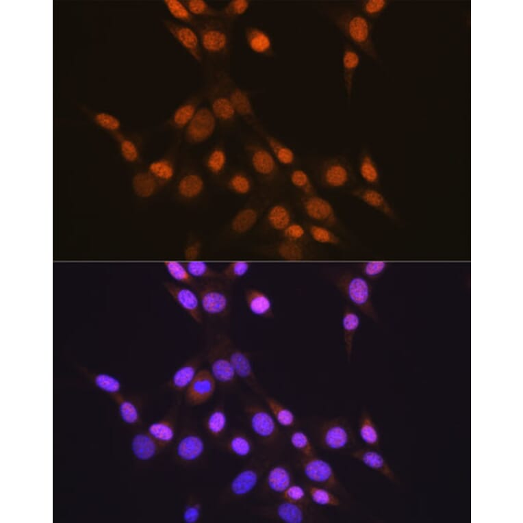Immunofluorescence - Anti-CTCF Antibody [ARC0067] (A308115) - Antibodies.com