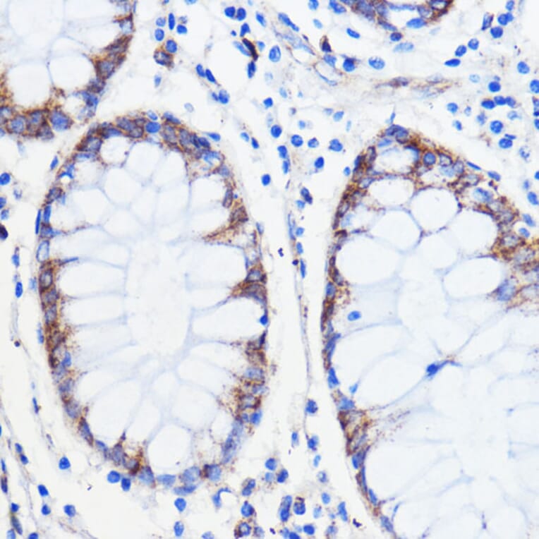Immunohistochemistry - Anti-p26 Antibody (A308116) - Antibodies.com