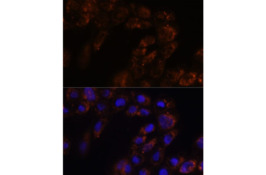 Immunofluorescence - Anti-p26 Antibody (A308116) - Antibodies.com