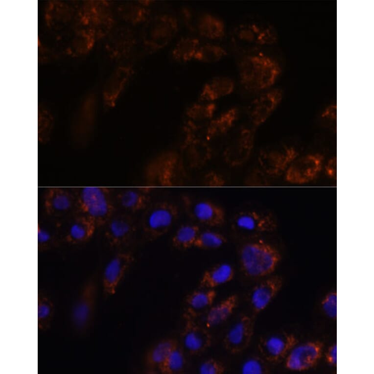 Immunofluorescence - Anti-p26 Antibody (A308116) - Antibodies.com