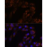 Immunofluorescence - Anti-p26 Antibody (A308116) - Antibodies.com