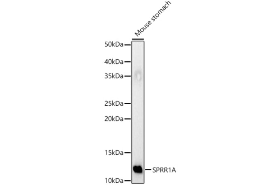 Western Blot - Anti-SPRR1A Antibody (A308117) - Antibodies.com