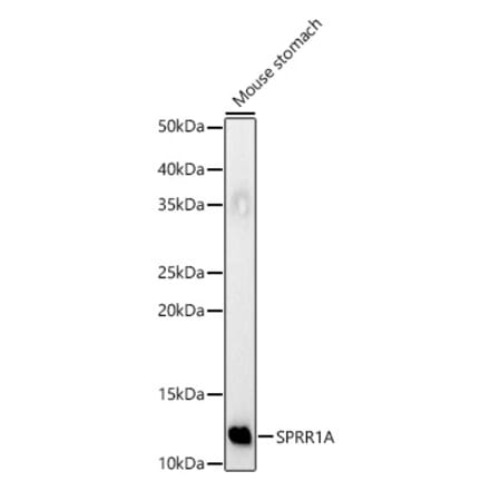 Western Blot - Anti-SPRR1A Antibody (A308117) - Antibodies.com