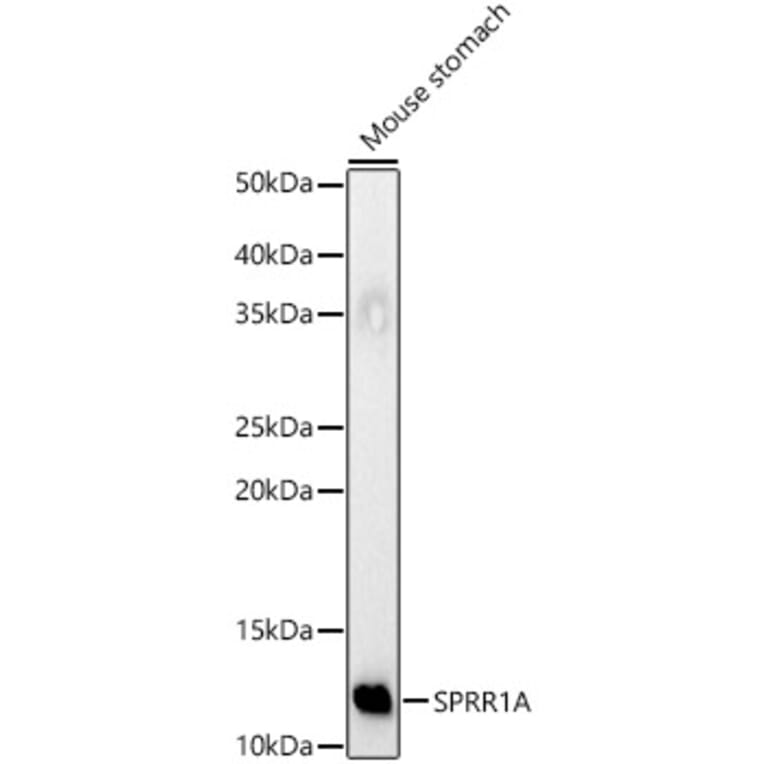 Western Blot - Anti-SPRR1A Antibody (A308117) - Antibodies.com