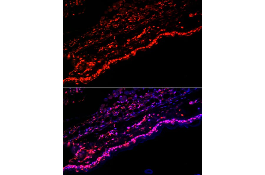 Immunofluorescence - Anti-SPRR1A Antibody (A308117) - Antibodies.com