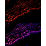 Immunofluorescence - Anti-SPRR1A Antibody (A308117) - Antibodies.com