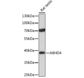 Western Blot - Anti-ABHD4 Antibody (A308120) - Antibodies.com