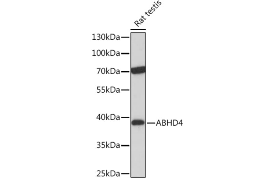 Western Blot - Anti-ABHD4 Antibody (A308120) - Antibodies.com