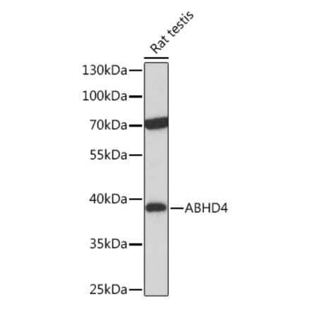 Western Blot - Anti-ABHD4 Antibody (A308120) - Antibodies.com