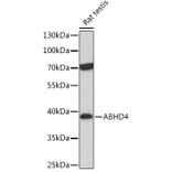 Western Blot - Anti-ABHD4 Antibody (A308120) - Antibodies.com