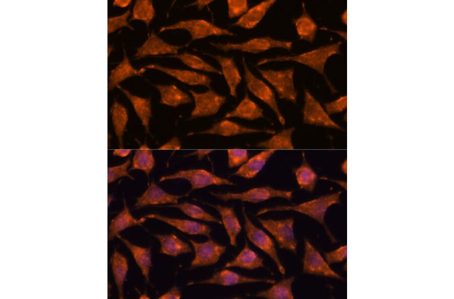 Immunofluorescence - Anti-ABHD4 Antibody (A308120) - Antibodies.com