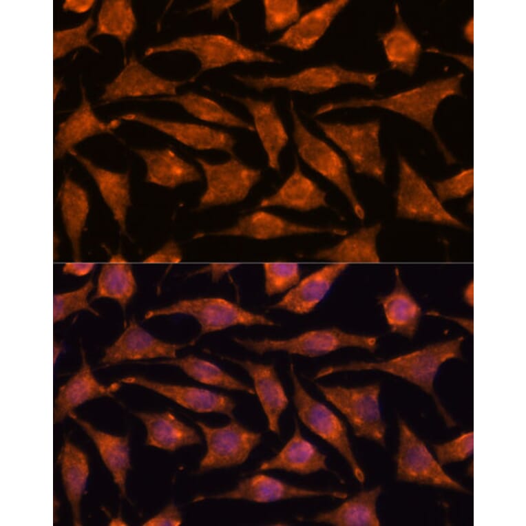 Immunofluorescence - Anti-ABHD4 Antibody (A308120) - Antibodies.com