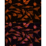 Immunofluorescence - Anti-ABHD4 Antibody (A308120) - Antibodies.com