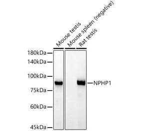 Western Blot - Anti-NPHP1 Antibody [ARC52339] (A308121) - Antibodies.com