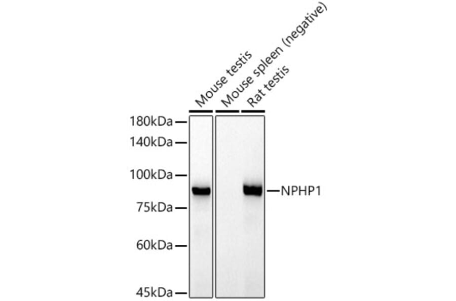 Western Blot - Anti-NPHP1 Antibody [ARC52339] (A308121) - Antibodies.com