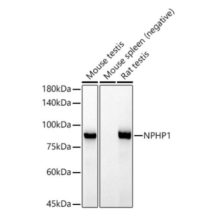 Western Blot - Anti-NPHP1 Antibody [ARC52339] (A308121) - Antibodies.com