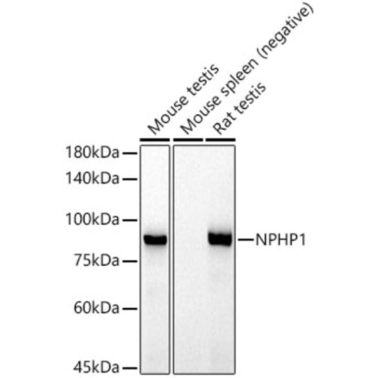 Western Blot - Anti-NPHP1 Antibody [ARC52339] (A308121) - Antibodies.com