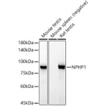Western Blot - Anti-NPHP1 Antibody [ARC52339] (A308121) - Antibodies.com