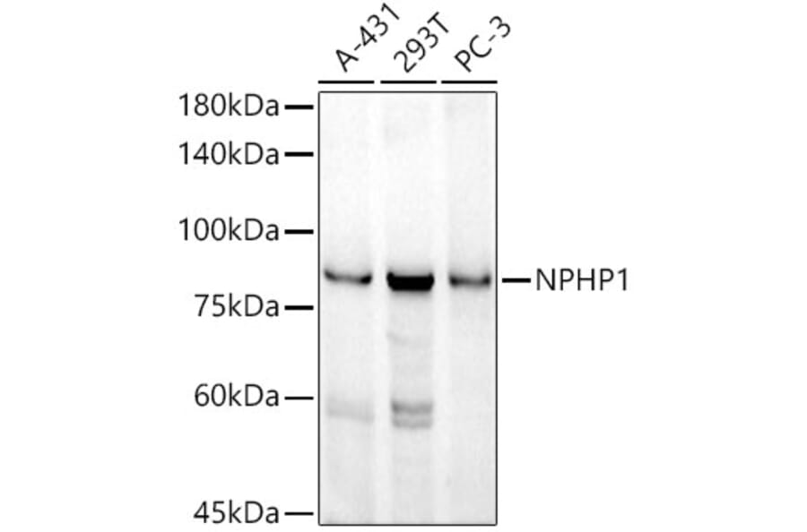 Western Blot - Anti-NPHP1 Antibody [ARC52339] (A308121) - Antibodies.com