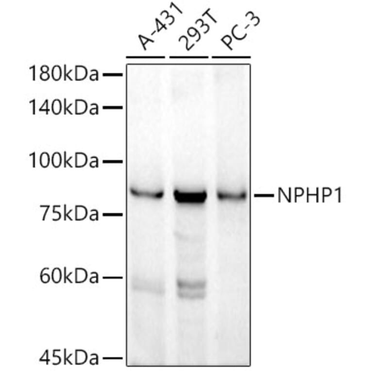Western Blot - Anti-NPHP1 Antibody [ARC52339] (A308121) - Antibodies.com