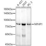 Western Blot - Anti-NPHP1 Antibody [ARC52339] (A308121) - Antibodies.com