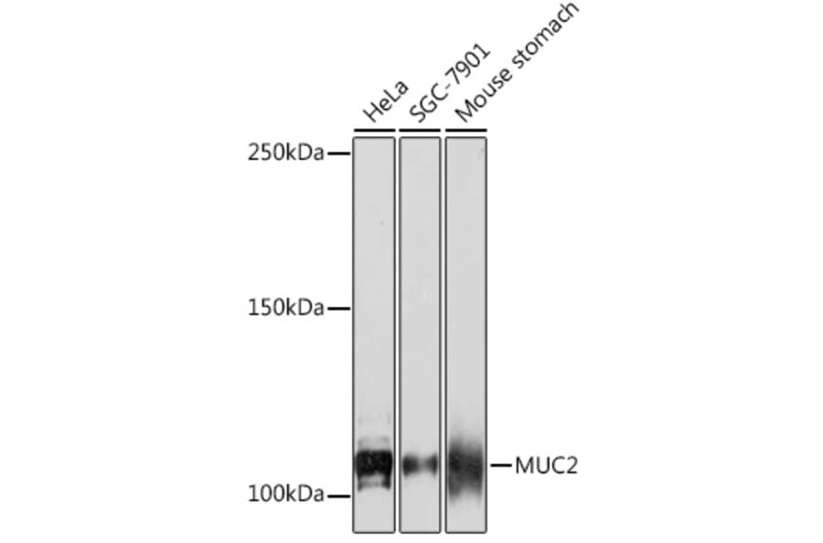 Western Blot - Anti-MUC2 Antibody [ARC1012] (A308122) - Antibodies.com