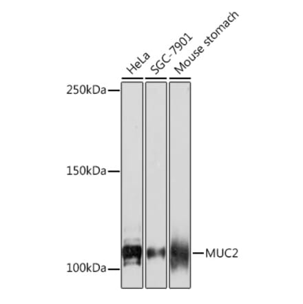 Western Blot - Anti-MUC2 Antibody [ARC1012] (A308122) - Antibodies.com