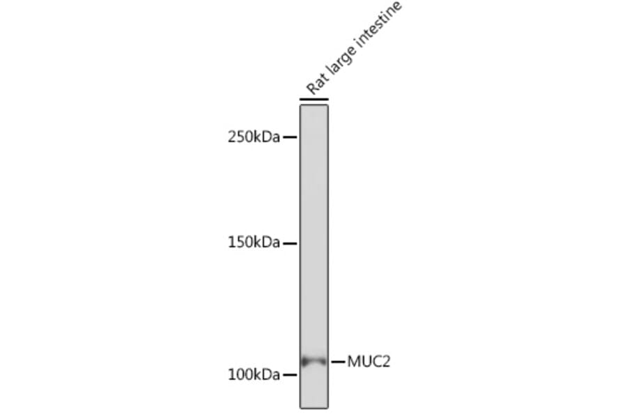 Western Blot - Anti-MUC2 Antibody [ARC1012] (A308122) - Antibodies.com