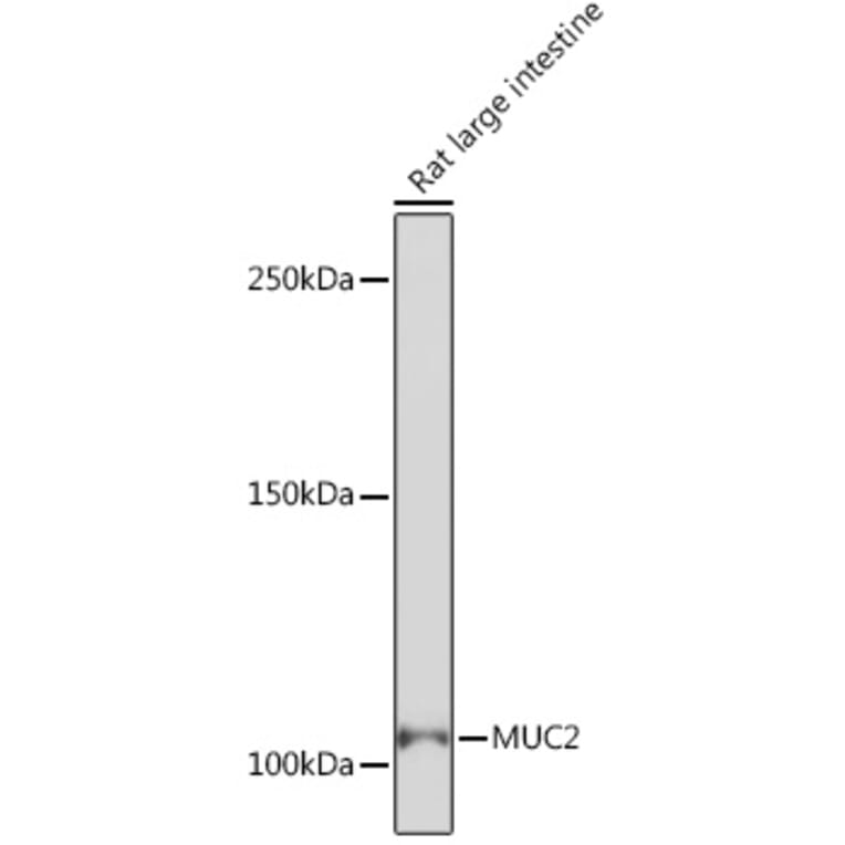 Western Blot - Anti-MUC2 Antibody [ARC1012] (A308122) - Antibodies.com