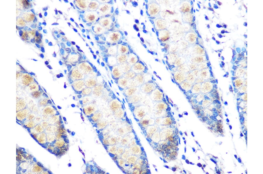 Immunohistochemistry - Anti-MUC2 Antibody [ARC1012] (A308122) - Antibodies.com