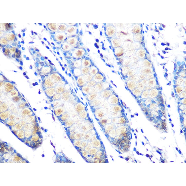 Immunohistochemistry - Anti-MUC2 Antibody [ARC1012] (A308122) - Antibodies.com