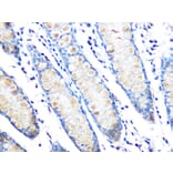 Immunohistochemistry - Anti-MUC2 Antibody [ARC1012] (A308122) - Antibodies.com