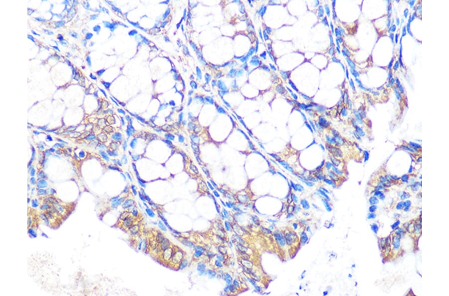 Immunohistochemistry - Anti-MUC2 Antibody [ARC1012] (A308122) - Antibodies.com