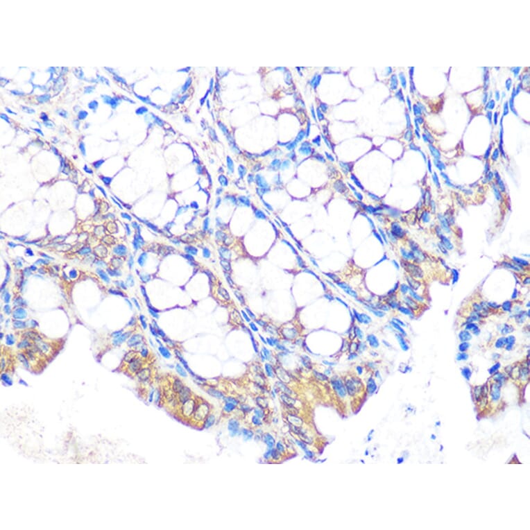 Immunohistochemistry - Anti-MUC2 Antibody [ARC1012] (A308122) - Antibodies.com