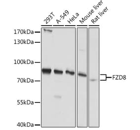 Western Blot - Anti-Frizzled 8 Antibody (A308123) - Antibodies.com