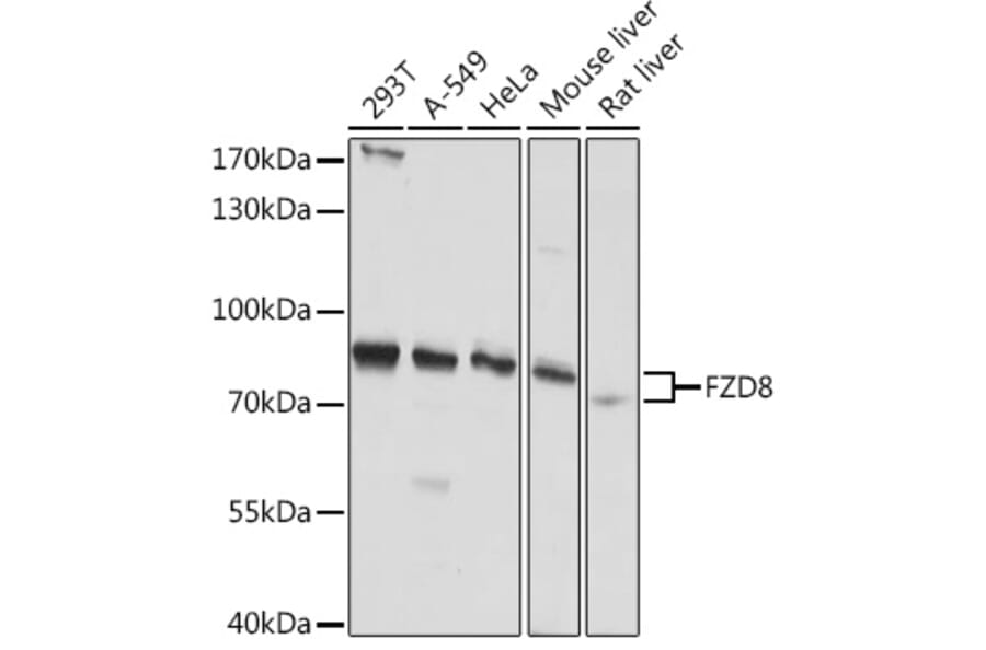 Western Blot - Anti-Frizzled 8 Antibody (A308123) - Antibodies.com