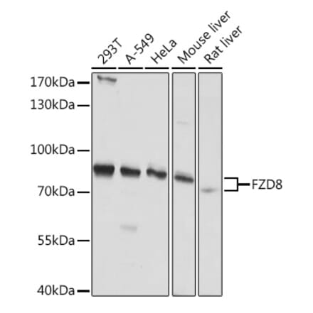 Western Blot - Anti-Frizzled 8 Antibody (A308123) - Antibodies.com