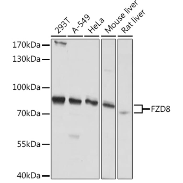 Western Blot - Anti-Frizzled 8 Antibody (A308123) - Antibodies.com