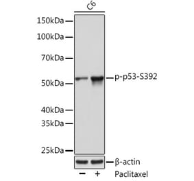 Western Blot - Anti-p53 (phospho Ser392) Antibody (A308124) - Antibodies.com