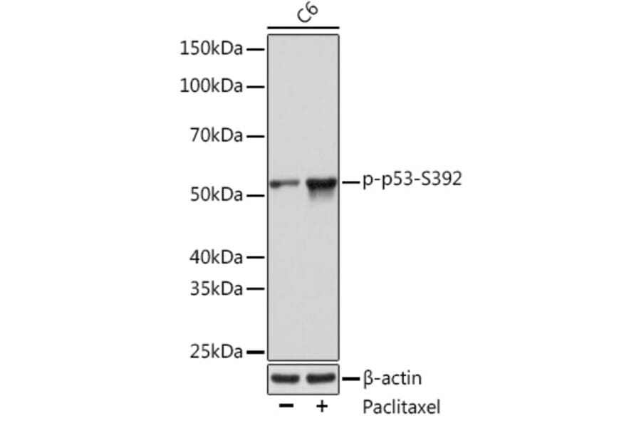 Western Blot - Anti-p53 (phospho Ser392) Antibody [ARC0309] (A308124) - Antibodies.com
