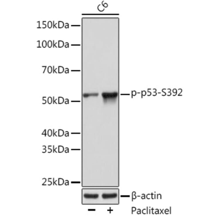 Western Blot - Anti-p53 (phospho Ser392) Antibody [ARC0309] (A308124) - Antibodies.com