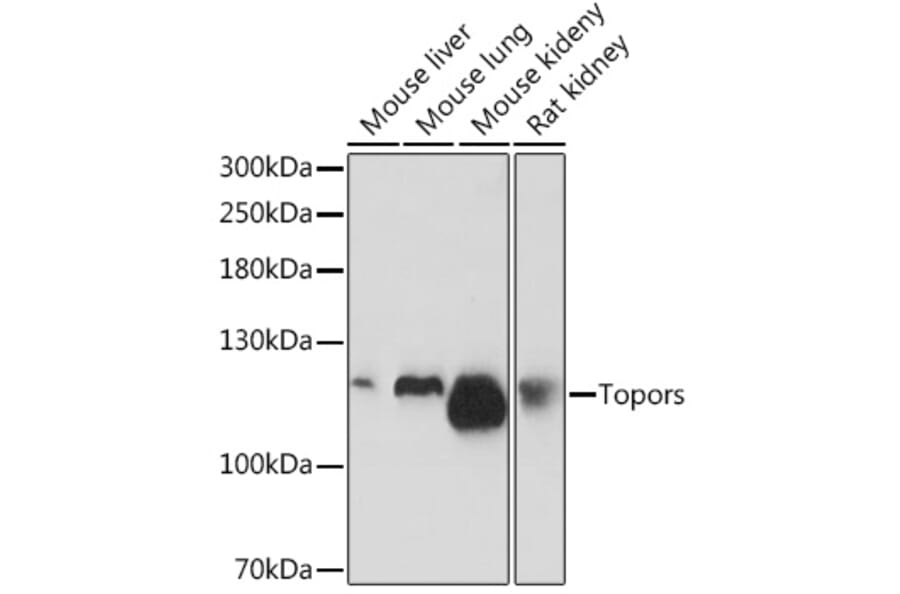 Western Blot - Anti-p53 BP3 Antibody (A308125) - Antibodies.com