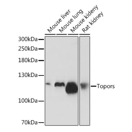 Western Blot - Anti-p53 BP3 Antibody (A308125) - Antibodies.com