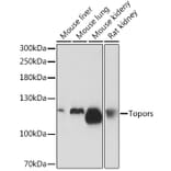 Western Blot - Anti-p53 BP3 Antibody (A308125) - Antibodies.com